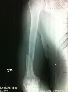 Nogueira_x-ray
