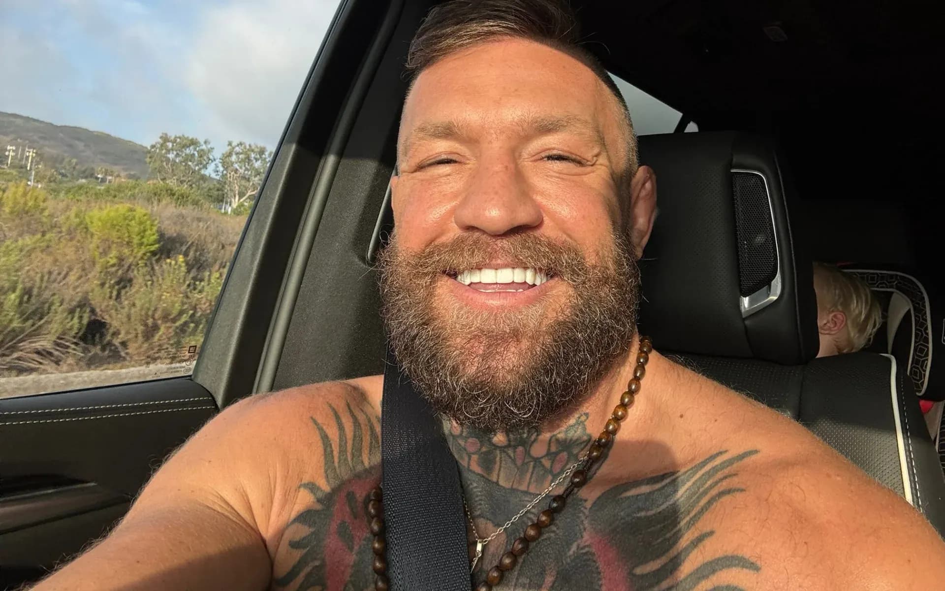Conor McGregor faced an injury setback at UFC 329