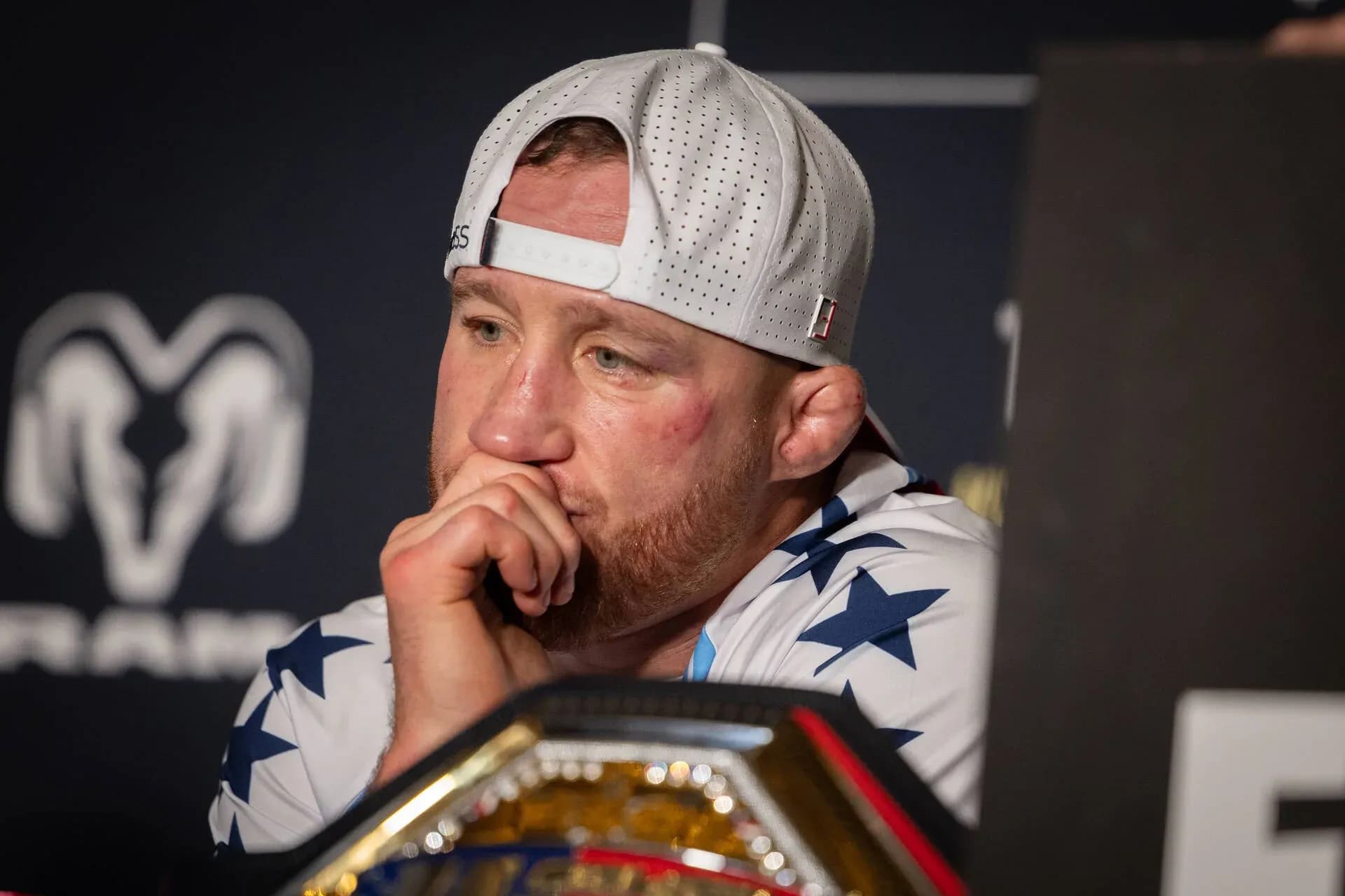 Justin Gaethje opens up on his battle scars after war with Ilia Topuria